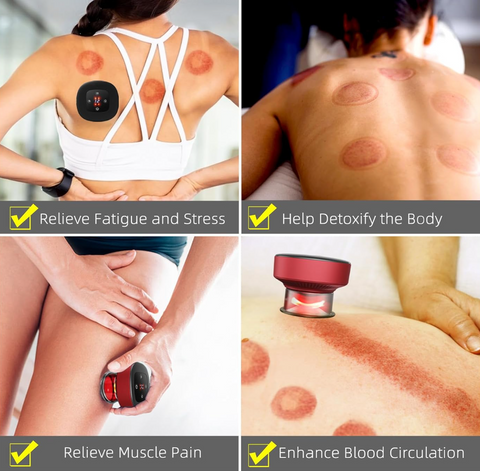 JYHealth Electronic Cupping Device